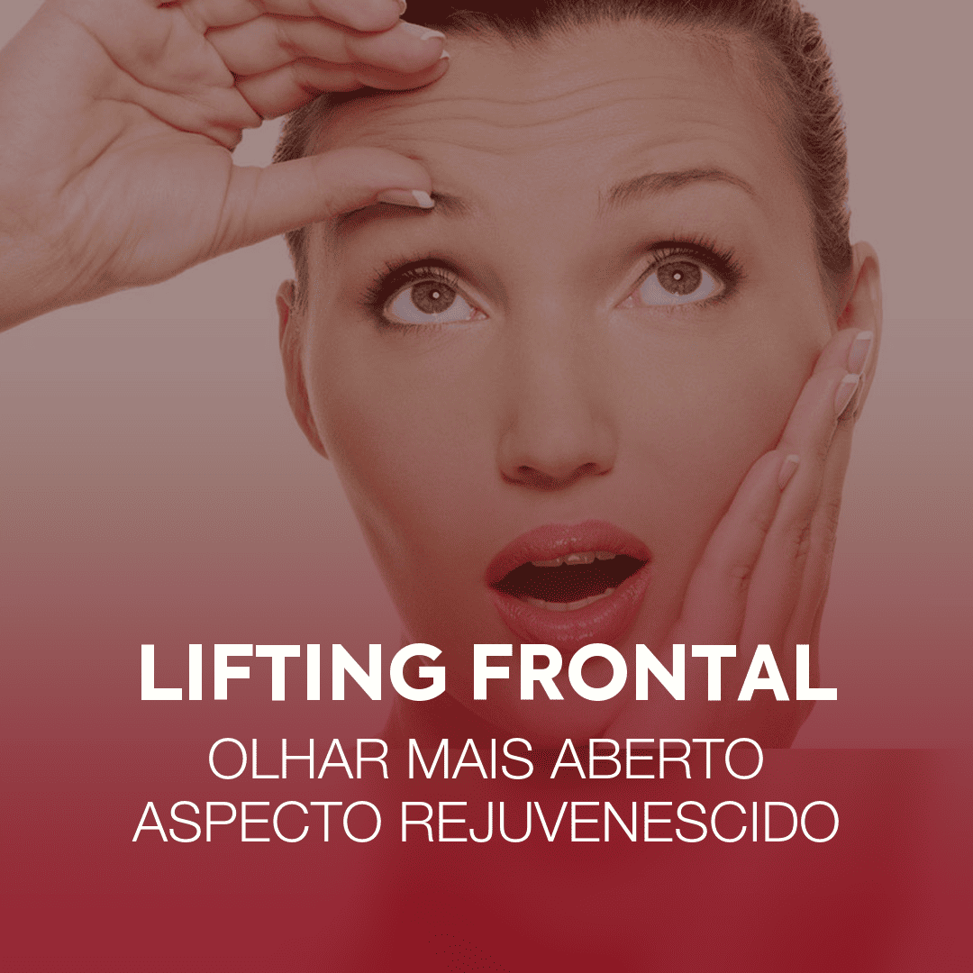 lifting-frontal