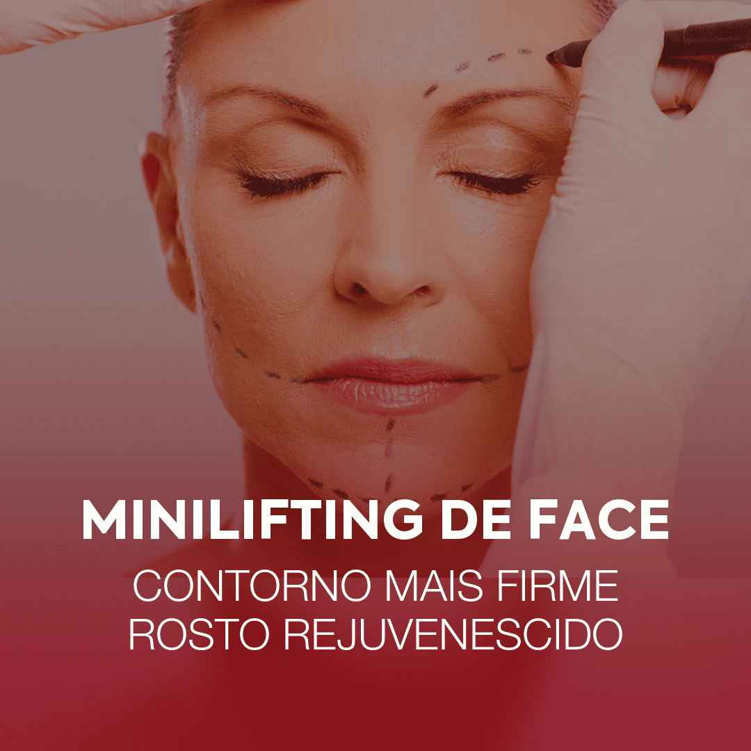 minilifting-de-face