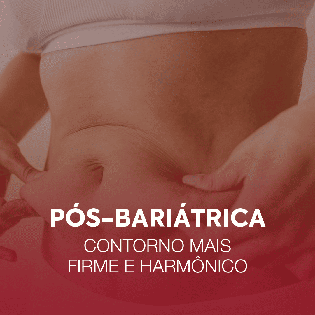 pos-bariatrica-peso-800 (1)